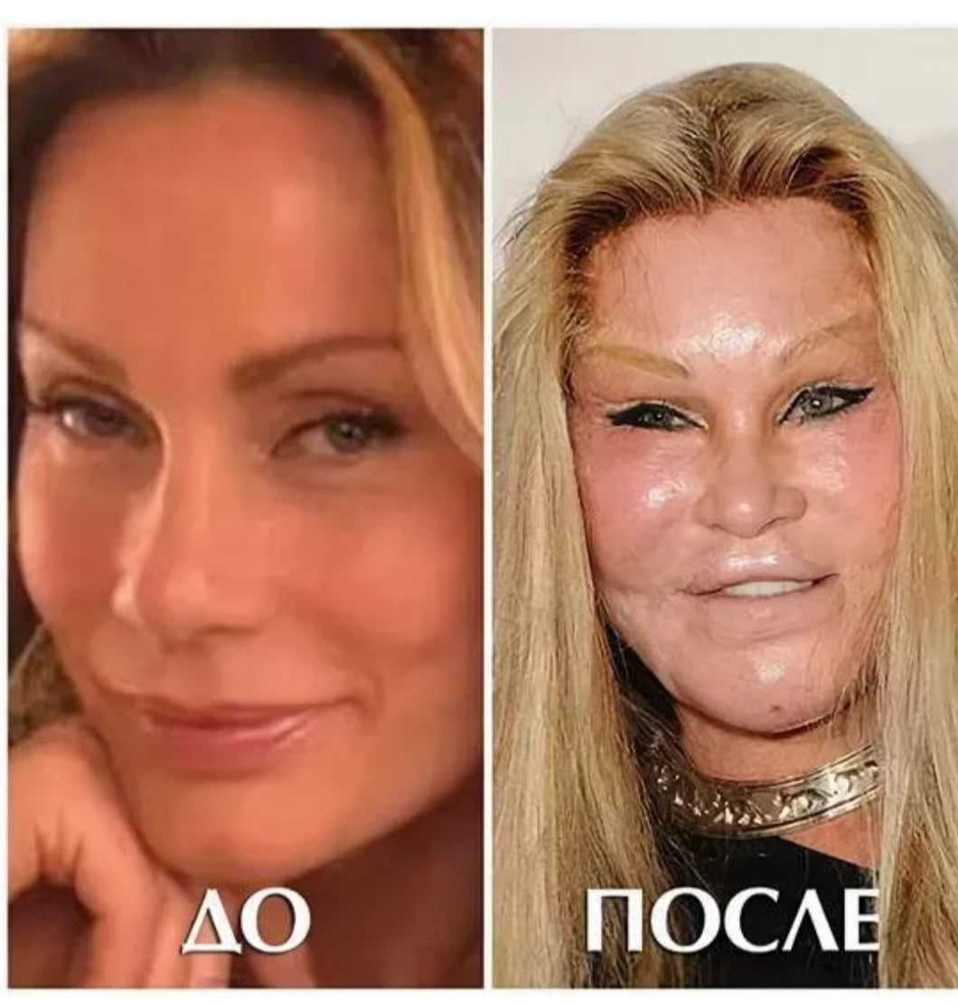 Красивые губы: как сделать объем
