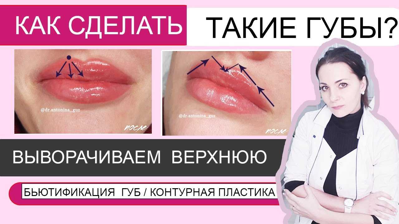 Увеличение губ — техника плоский бант