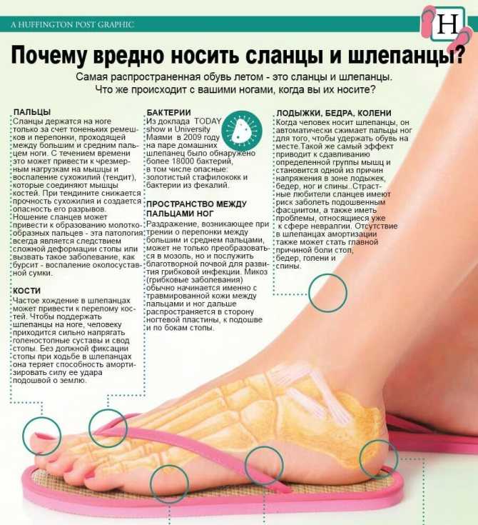 Какую обувь носили в ссср? вата, натертые мозоли и бедный ассортимент | кто?что?где?