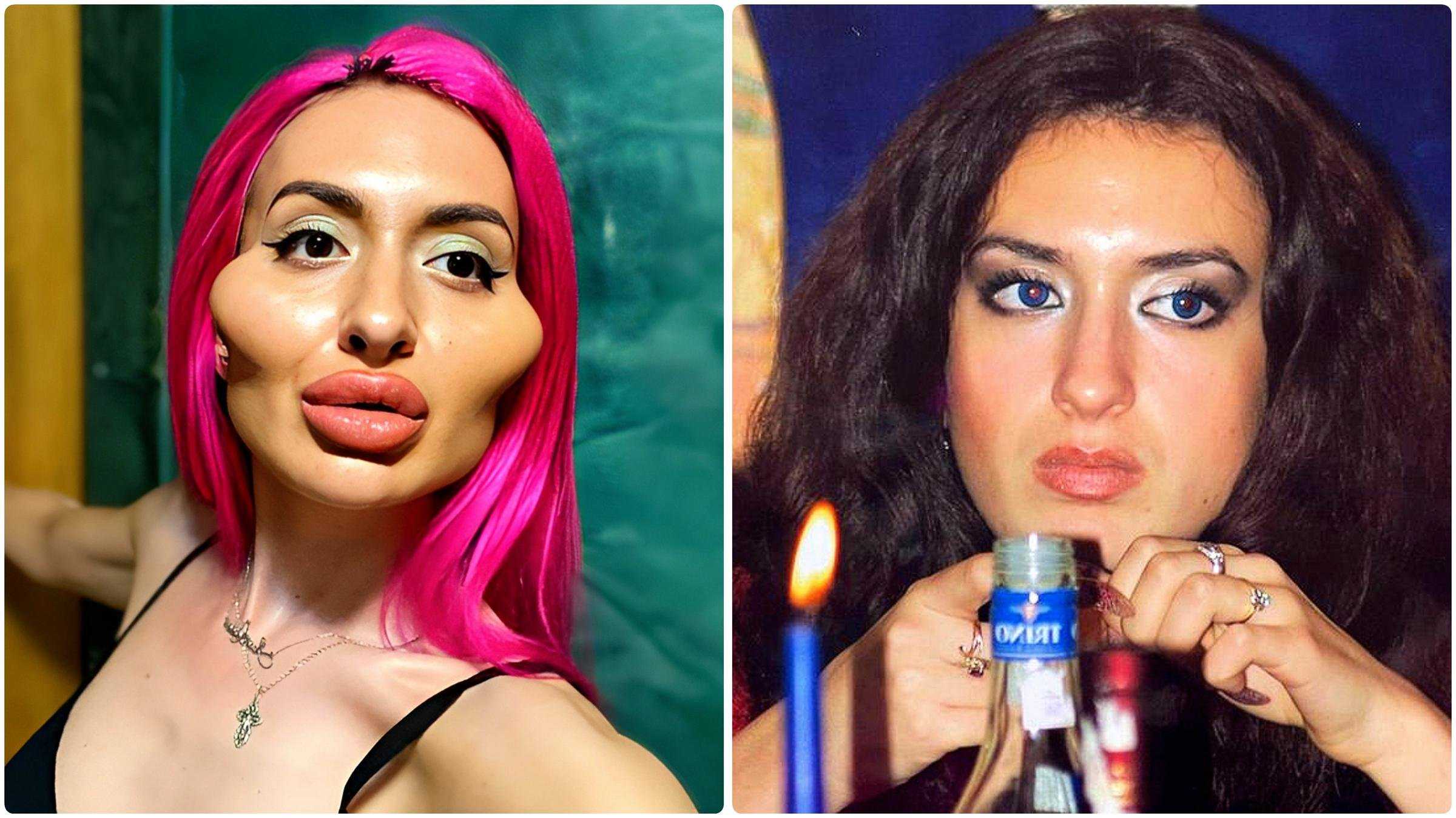 Как выглядит 32-летняя украинка, которая перекачала себе скулы - леди стиль жизни
