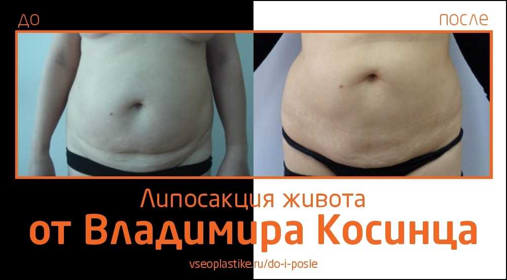 Не без проблем в третий круг: медведев ругался со зрителями, рублёв испытывал себя, касаткина выживала на us open