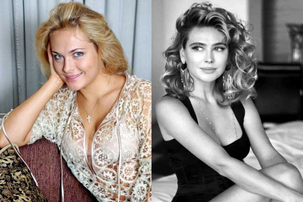 Анна горшкова: биография, личная жизнь, муж и дети, фото до и после пластики