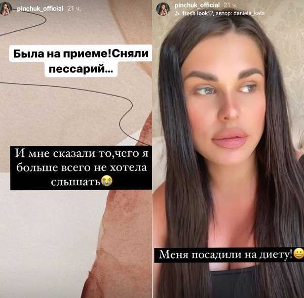 Ирина пинчук до и после пластики