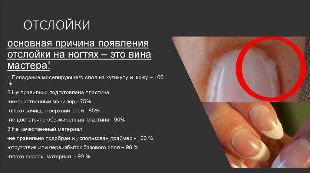 Как восстановить ногти после гель лака, как укрепить ногти после шеллака, как лечить, если болят ногти