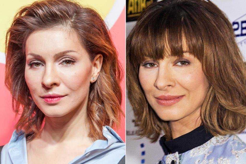 «идеальная» елена подкаминская до и после пластики