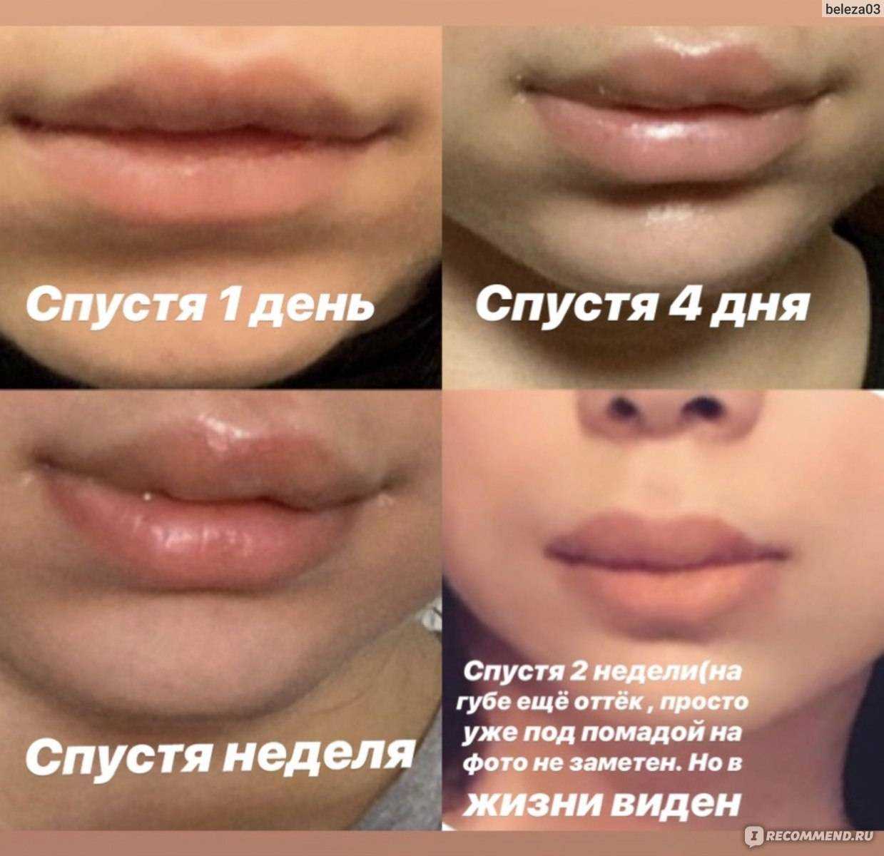 Ненакрашенные губы: жители аварийного дома на камчатке направили музыкальную жалобу путину  (видео)