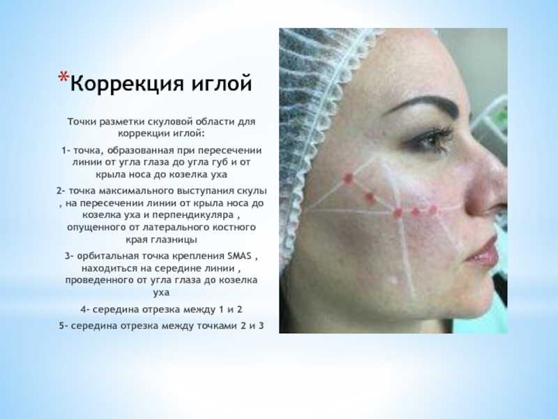Топ-12 лучших филлеров для скул на 2020 год в рейтинге zuzako