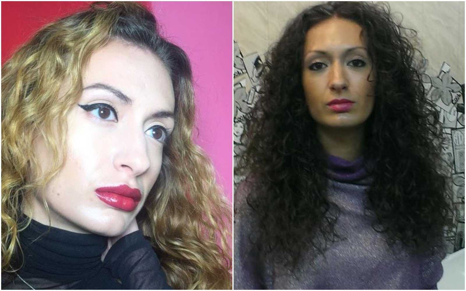 Как выглядит 31-летняя украинка, которая перекачала себе скулы