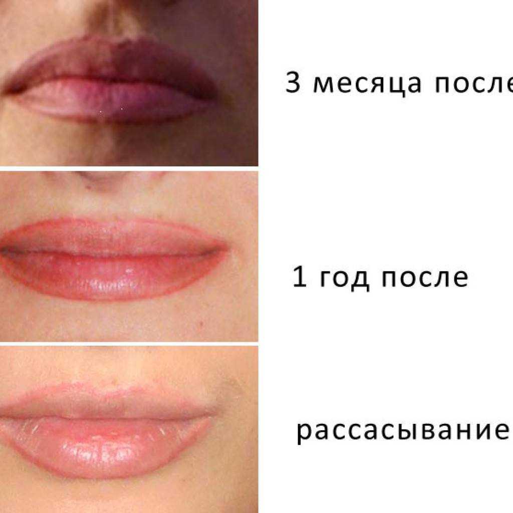 Перманентный макияж губ (татуаж губ) - что это, фото до и после