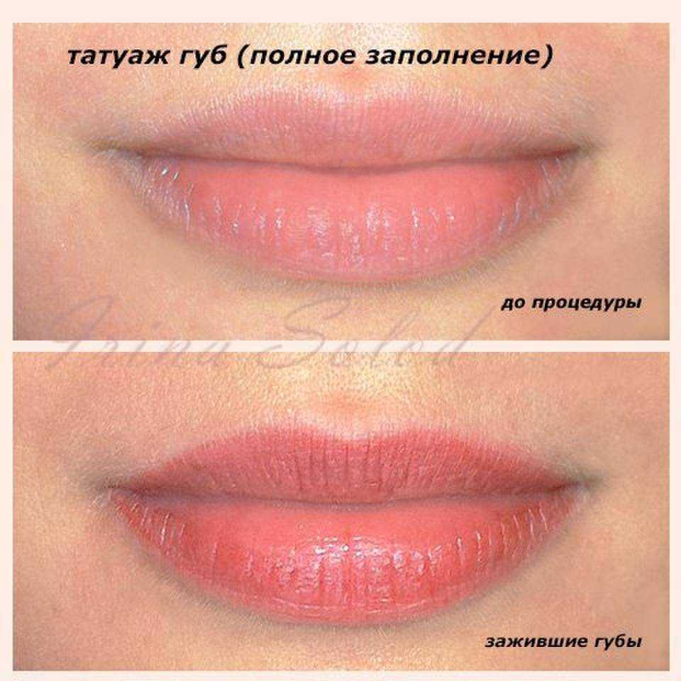 Техники татуажа губ: фото до и после процедуры