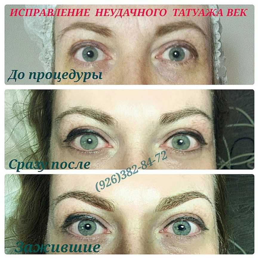 Как делают татуаж межресничного пространства - отзывы и фото